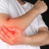Teniski lakat rehabilitacija: kako da se vratiš svakodnevnim aktivnostima bez bola